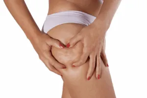 Scopri di più sull'articolo Dieta Anticellulite